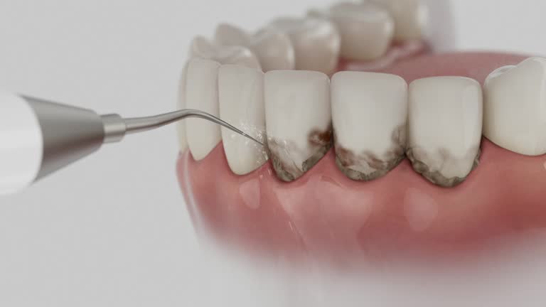 Trusted Dental Implants service in Mount Sterling, IL - Dentist Open Now